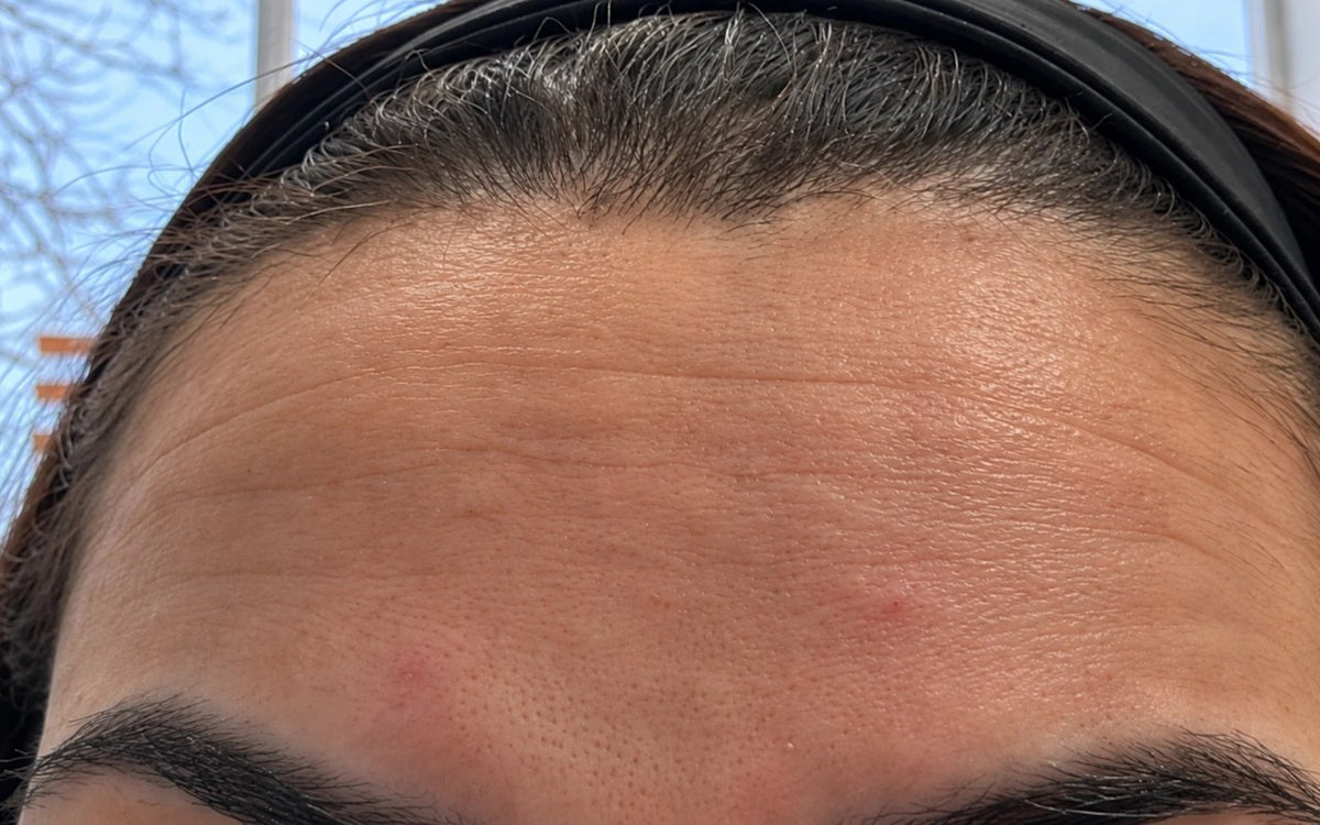 Antes